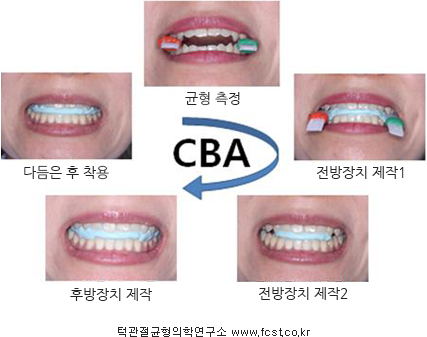 맞춤형경추균형장치